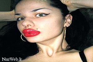 دختر دو آتیشه با بزرگترین لب های جهان / عکس