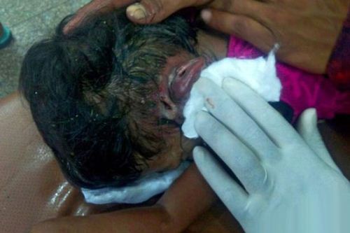 دختری که 80 کرم از گوشش بیرون کشید! تصاویر 18+