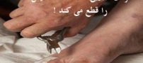 مرد عجیبی که انگشت هایش را با انبر قطع می کند! تصاویر 16+