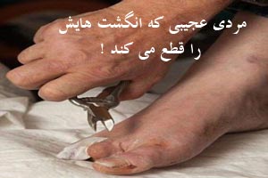 مرد عجیبی که انگشت هایش را با انبر قطع می کند! تصاویر 16+