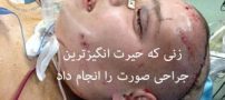 عکس های زنی که جنجالی ترین عمل زیبایی را انجام داد