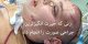 عکس های زنی که جنجالی ترین عمل زیبایی را انجام داد