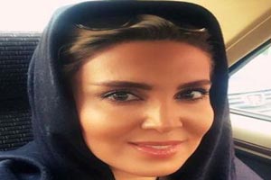 عکس های لیلا بلوکات و عمل زیبایی جدید