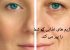 رژیم های لاغری که شما را پیر می کند