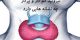 تیروئید پر کار و کم کار چه نشانه هایی دارد