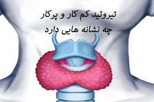 تیروئید پر کار و کم کار چه نشانه هایی دارد