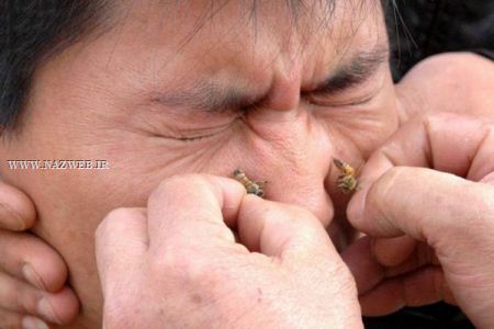 عجیب و تکان دهنده ترین روش های درمانی و جنجالی دنیا ! تصاویر 18+