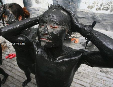 عجیب و تکان دهنده ترین روش های درمانی و جنجالی دنیا ! تصاویر 18+