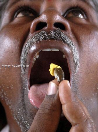 عجیب و تکان دهنده ترین روش های درمانی و جنجالی دنیا ! تصاویر 18+