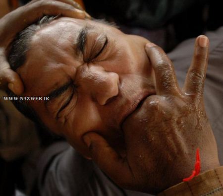 عجیب و تکان دهنده ترین روش های درمانی و جنجالی دنیا ! تصاویر 18+