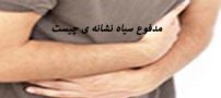مدفوع سیاه نشانه ی چیست ؟