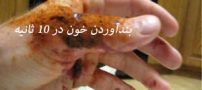 خون را در 10 ثانیه بند آورید + روش