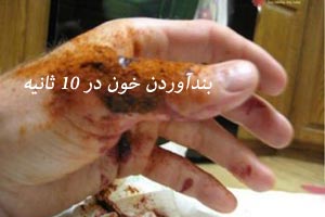 خون را در 10 ثانیه بند آورید + روش خون را در 10 ثانیه بند آورید + روش