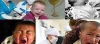 سوزن 4 سانتی در بدن نوزاد 11 ماهه در قشم! عکس