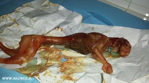 بیرون کشیدن جنین خرگوش از واژن زن باردار ! تصاویر 18+