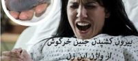 بیرون کشیدن جنین خرگوش از واژن زن باردار ! تصاویر 18+