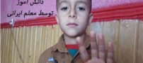 معلم بی رحم ایرانی دست دانش آموزش را سوزاند (عکس)