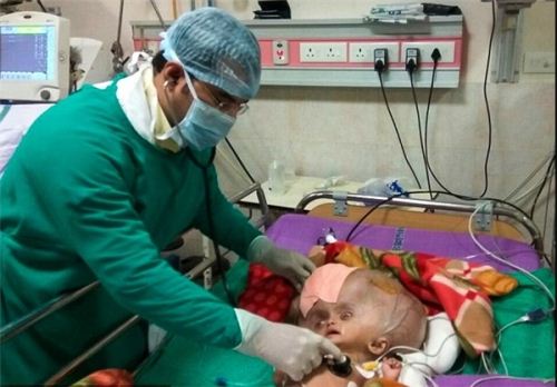 نوزادی که بزرگترین سر دنیا را دارد !! تصاویر