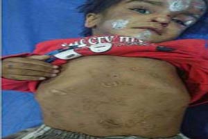 والدین معتاد ته سیگارشان را با بدن دخترشان خاموش می کنند! عکس 18+ والدین معتاد ته سیگارشان را با بدن دخترشان خاموش می کنند! عکس 18+