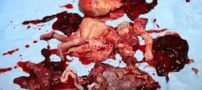 زایمان جنجالی و ناگهانی این دختر در دستشویی مدرسه ! عکس 18+