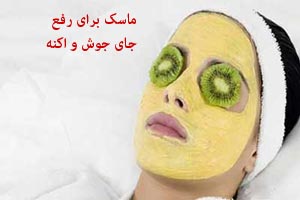 ماسک های عالی برای رفع جوش و آکنه ویژه نوروز ماسک های عالی برای رفع جوش و آکنه ویژه نوروز