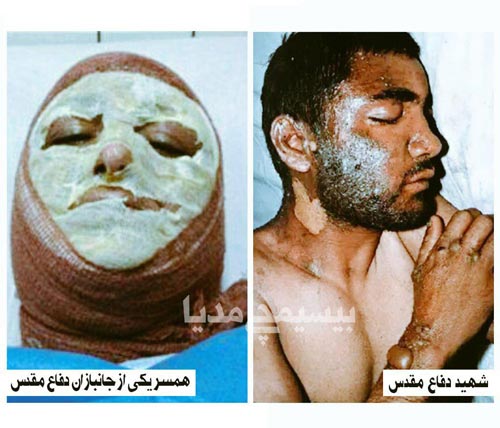 خود سوزی جنجالی همسر یک جانباز مقابل بنیاد شهید (عکس 18+)