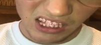 دندان های صورتی با یاقوت های جواهر جاستین بیبر جنجالی شد (تصاویر)