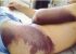 تب کشنده کنگو از چه راهی به انسان منتقل می شود