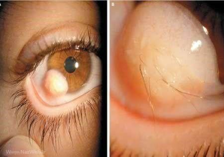 این افراد ترسناک و عجیب ترین چشمهای دنیا را دارند