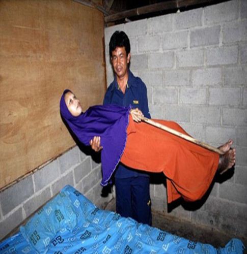 زنی که به یک مجسمه یا چوب خشک تبدیل شده (عکس)