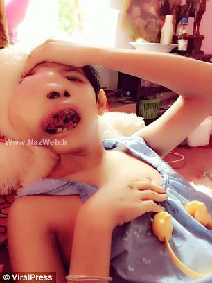 فک عجیب دختری که در حال رشد است! تصاویر 18+