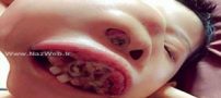 فک عجیب دختری که در حال رشد است! تصاویر 18+