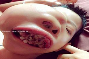 فک عجیب دختری که در حال رشد است! تصاویر 18+