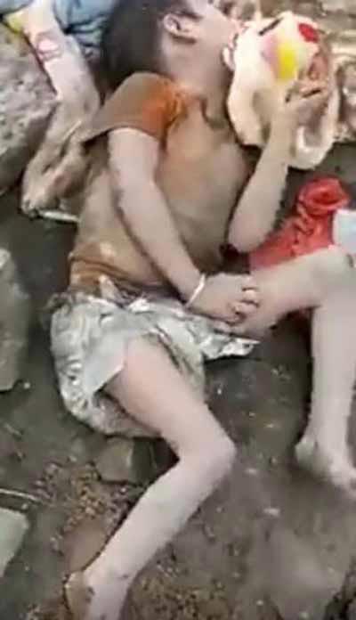 دختری که بدنش زنده زنده خوراک حشرات شد (تصاویر)