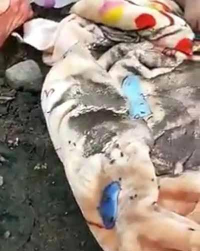 دختری که بدنش زنده زنده خوراک حشرات شد (تصاویر)