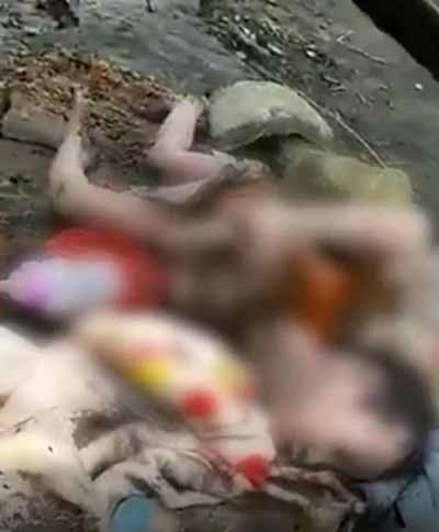 دختری که بدنش زنده زنده خوراک حشرات شد (تصاویر)