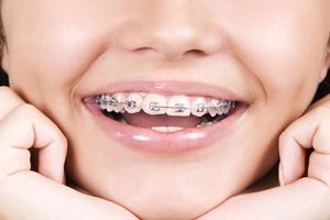 کراس بایت چیست کراس بایت چیست