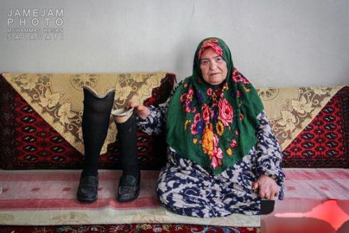 گزارش تکان دهنده شهرک جذامی ها در مشهد (18+ تصاویر)