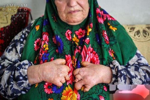 گزارش تکان دهنده شهرک جذامی ها در مشهد (18+ تصاویر)