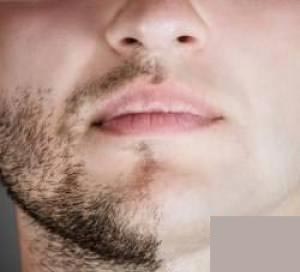 آموزش تهیه وکس یا موبر خانگی با آبلیمو و شکر