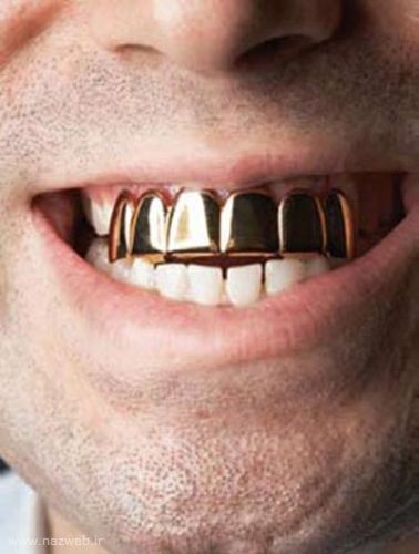 مد جنجالی و جدید دختران تهرانی + عکس