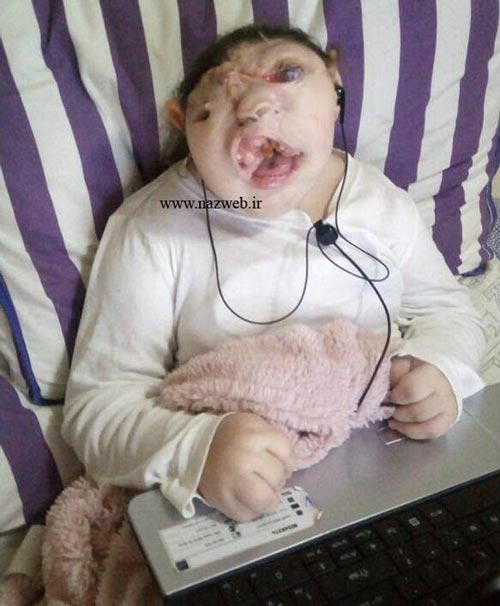 دختر عجیبی که صورتش استخوان ندارد | تصاویر 18+