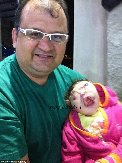 دختر عجیبی که صورتش استخوان ندارد | تصاویر 18+