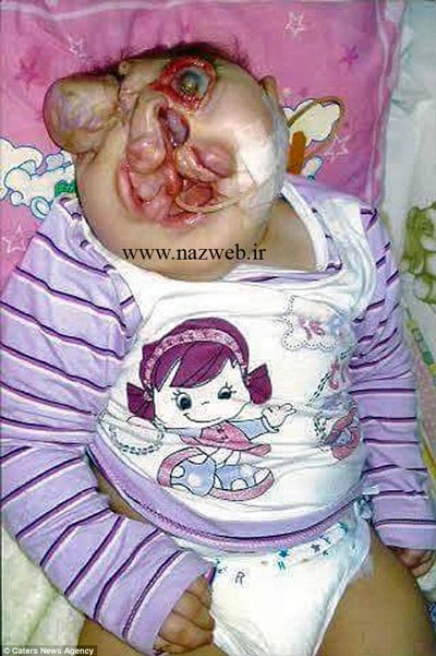 دختر عجیبی که صورتش استخوان ندارد | تصاویر 18+
