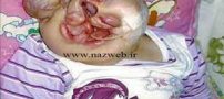 دختر عجیبی که صورتش استخوان ندارد | تصاویر 18+