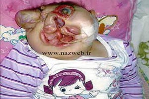 دختر عجیبی که صورتش استخوان ندارد | تصاویر 18+ دختر عجیبی که صورتش استخوان ندارد | تصاویر 18+