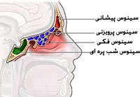 سینوزیت چیست + درمان خانگی