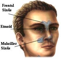 سینوزیت چیست + درمان خانگی