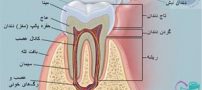آناتومی، اینفوگرافی کامل دندان | مقاله و تحقیق