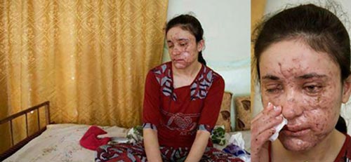 همخوابی وحشتناک با دختر 18 ساله + عکس